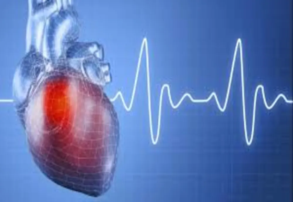 Bolile cardiovasculare