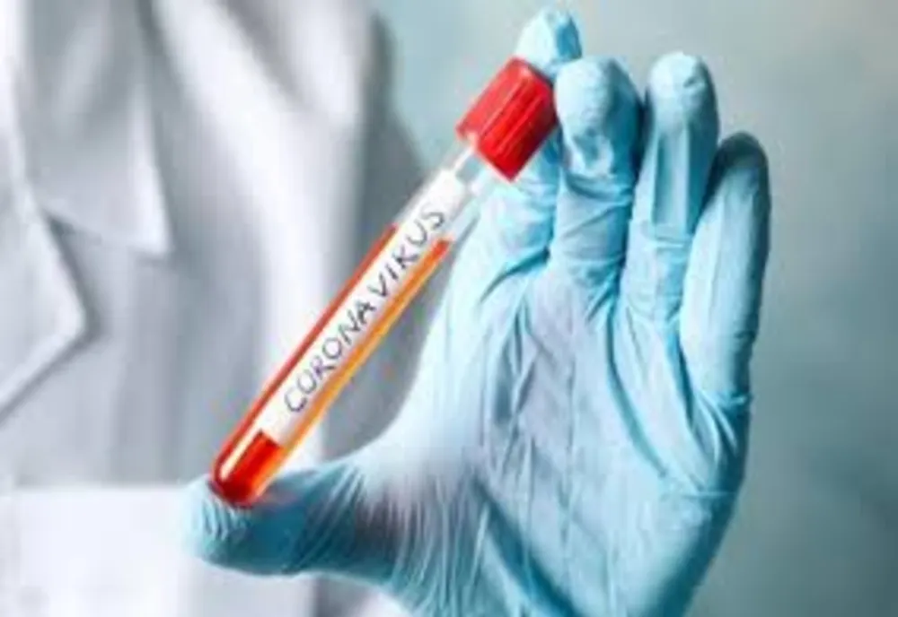 Al 29-lea caz de coronavirus confirmat în România