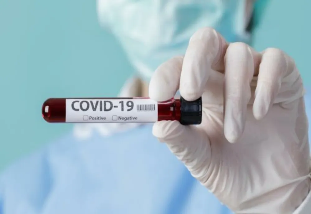 Bilanț COVID pentru ultimele 24 de ore:  1.136 de cazuri noi și  41 de decese/ 460 dintre cei infectați se află în secțiile ATI