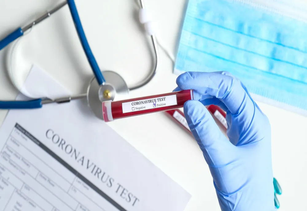 Comuna monitorizată după ce s-au înregistrat mai multe cazuri de coronavirus
