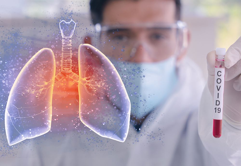 462 de sibieni infectați cu COVID-19 s-au vindecat