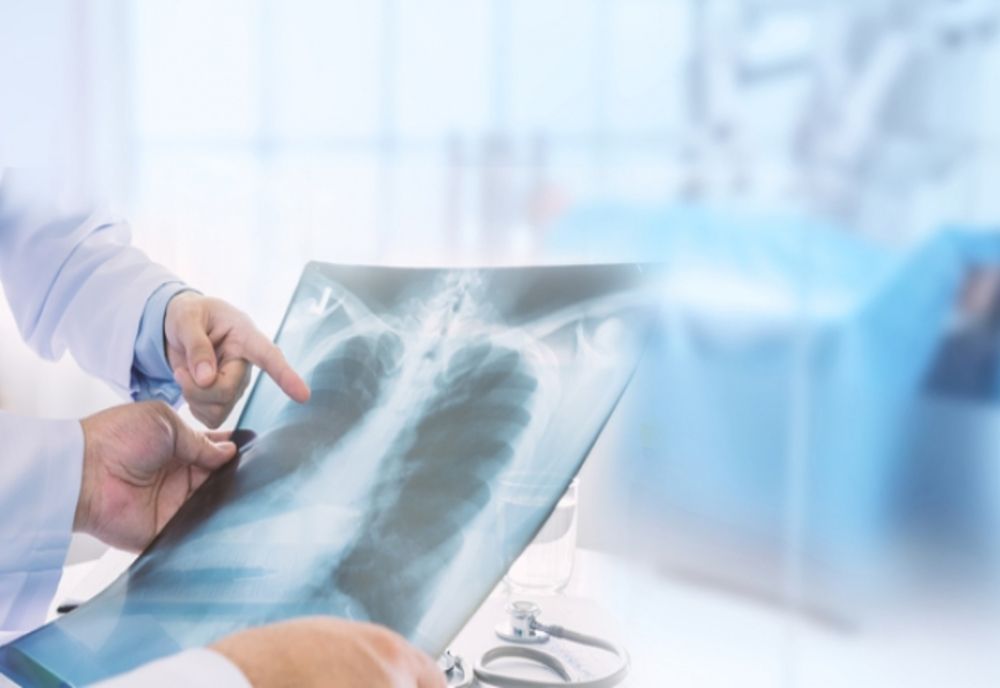 Medic specialist pneumolog din Sibiu, la Spitalul Municipal Făgăraş