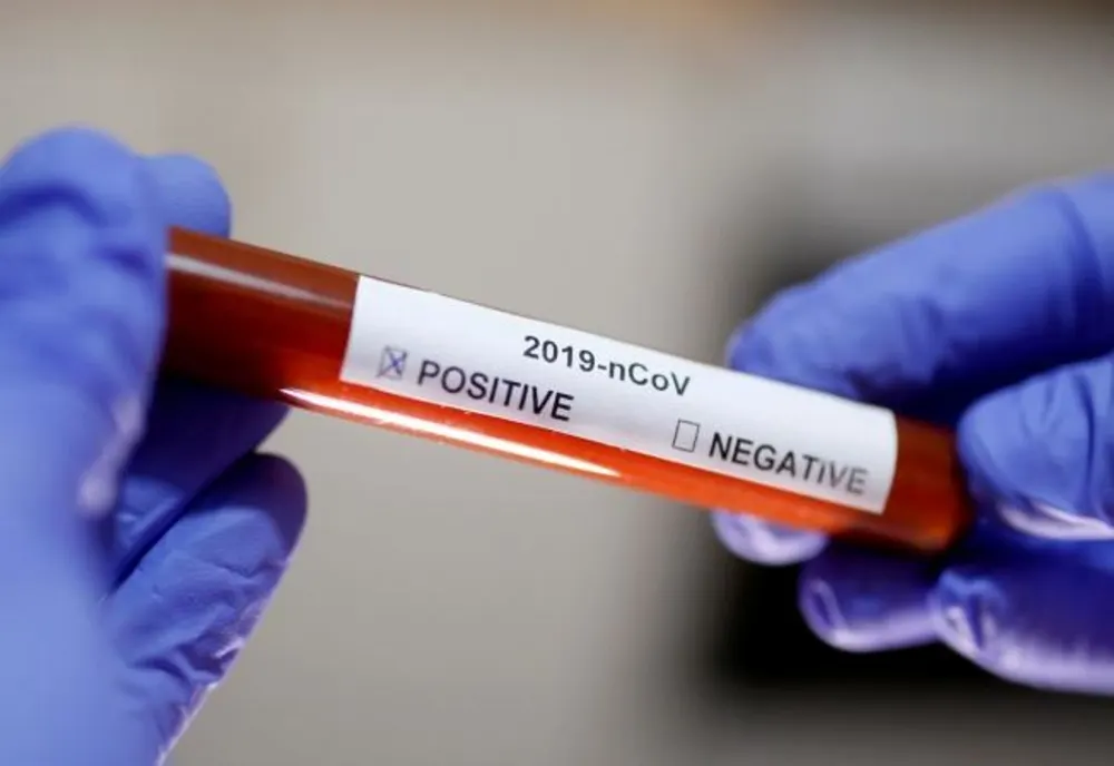 166 de cazuri de coronavirus, confirmate în județul Sibiu
