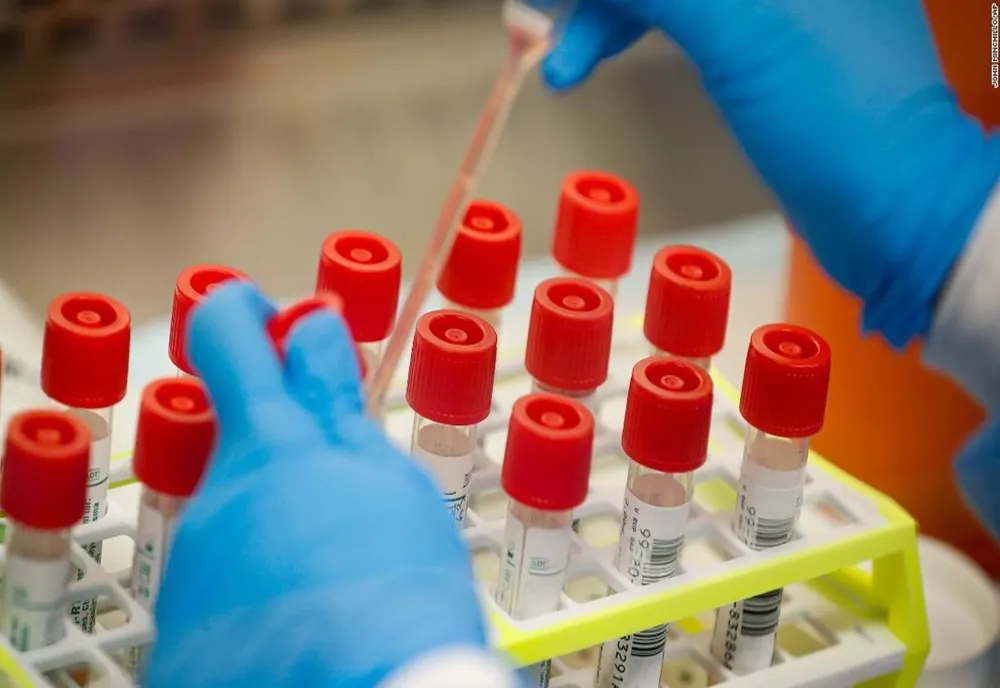 35 de sibieni infectați cu COVID-19, vindecați și externați