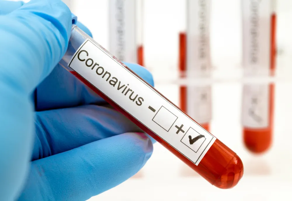424 de cazuri confirmate cu coronavirus, în județul Sibiu