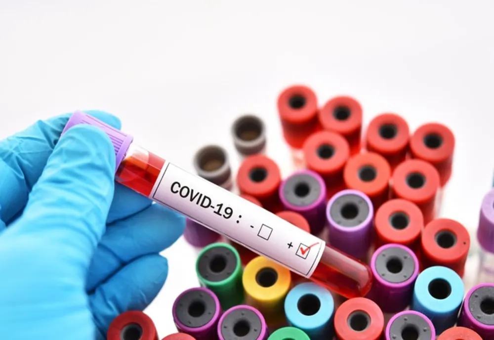 465 de sibieni infectați cu COVID-19 s-au vindecat. 45 au murit