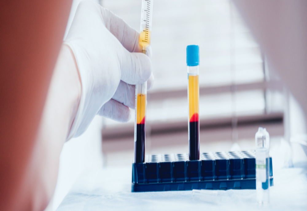 SCJU Sibiu a primit avizul Ministerului Sănătății pentru tratamentul cu plasmă umană hiperimună pentru pacienți cu COVID-19