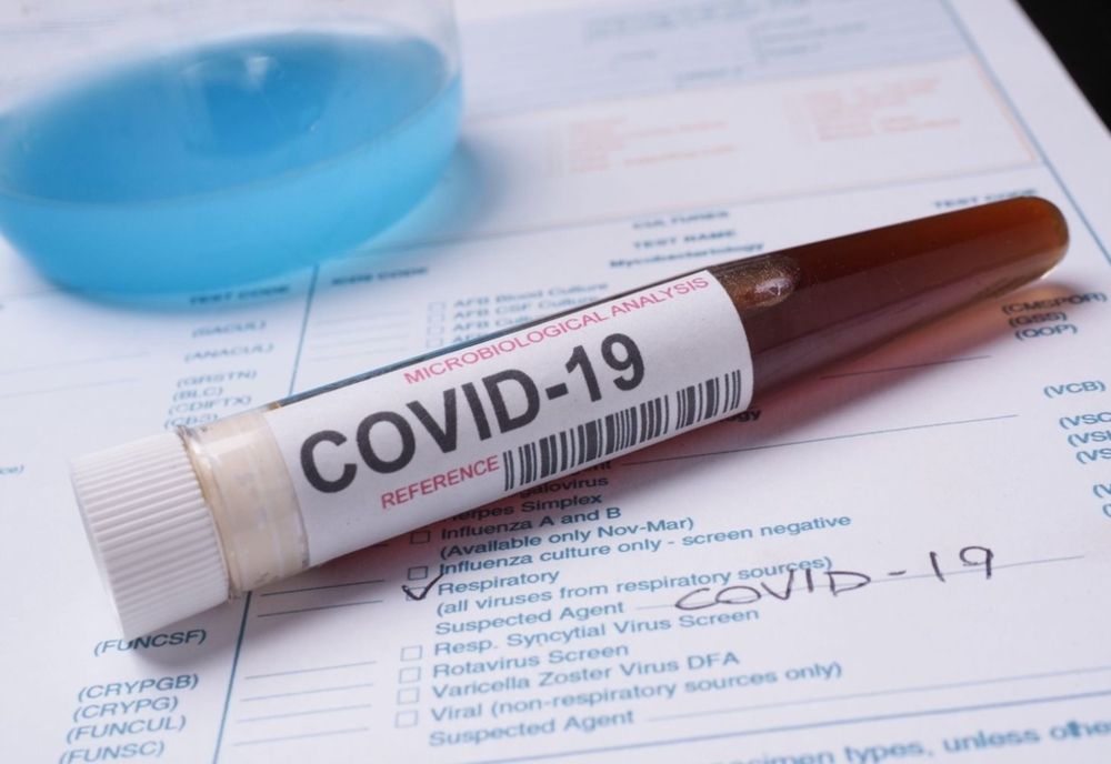 494 de cazuri de coronavirus, confirmate în Sibiu