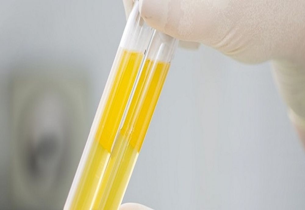 Spitalul Județean Sibiu face apel la pacienții vindecați de COVID-19 să doneze plasmă