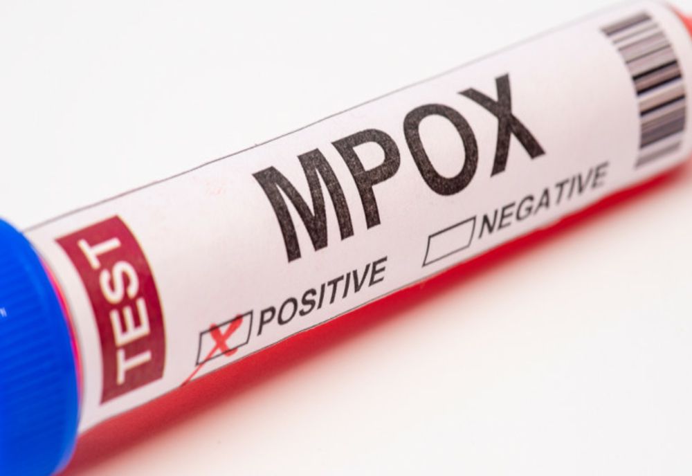 COMITET DE URGENȚĂ, CONVOCAT DE OMS PE TEMA MPOX