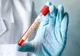 Al 29-lea caz de coronavirus confirmat în România