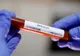 Cinci noi cazuri de coronavirus, confirmate în județul Sibiu. În total, 182