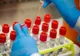 509 cazuri de coronavirus, confirmate în județul Sibiu